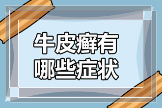 牛皮癣癣和皮炎 的区别从哪里体现